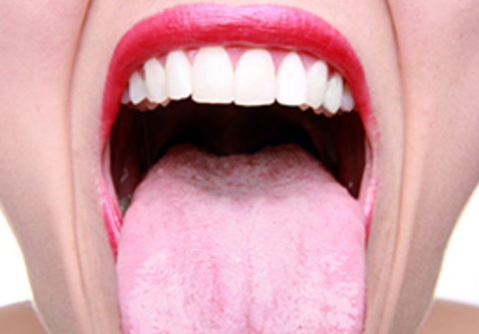 do an authentic Traditional Chinese Medicine Tongue